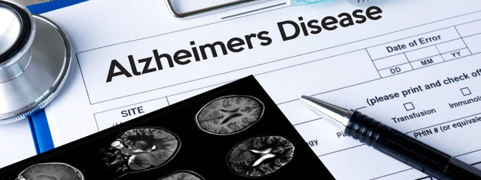 artificial-intelligence-detect-alzheimers-disease