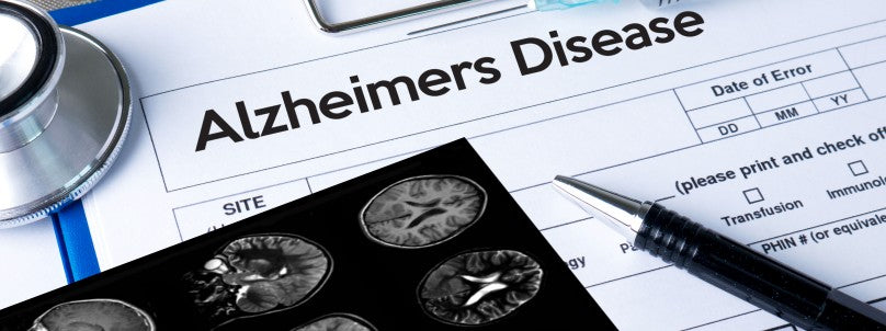 artificial-intelligence-detect-alzheimers-disease
