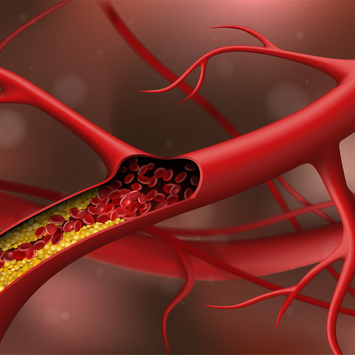 Blood Lipid Levels: What They Are and Why They Matter