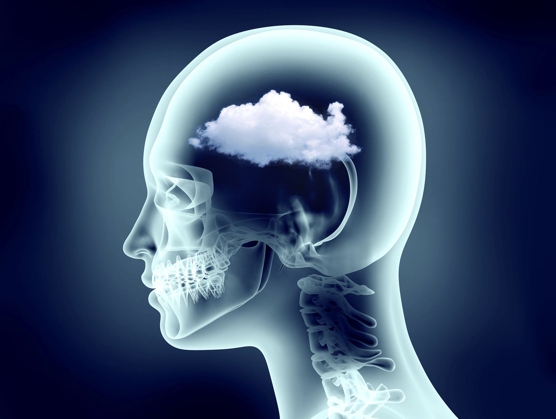 Brain Fog: How to Fix It & What Lifestyle Choices Lead to It