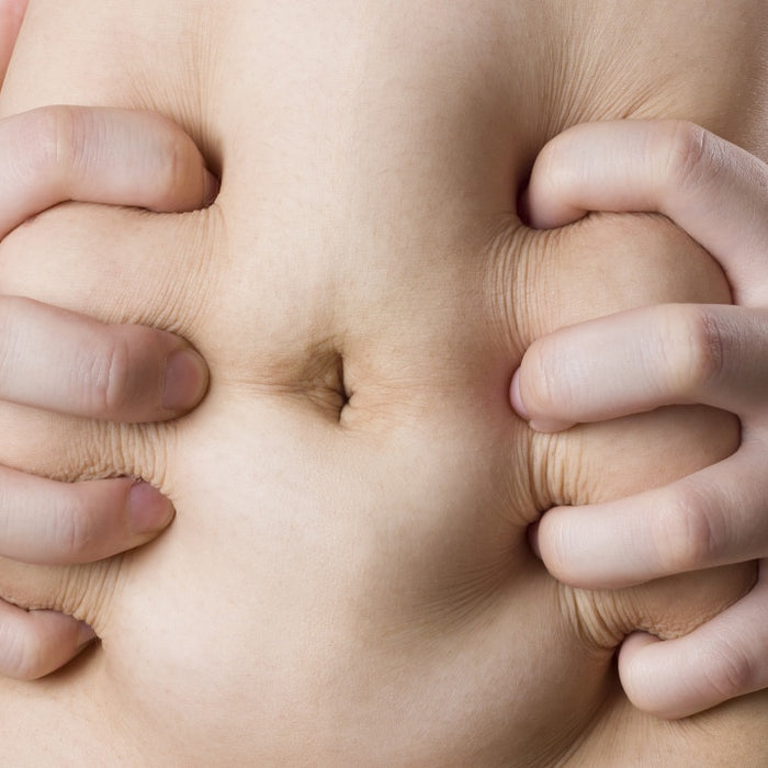 Loose Skin After Weight Loss: Reality and Facts