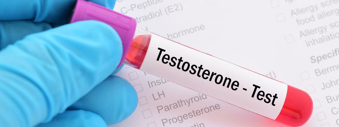 How to Increase Testosterone: 9 Best Natural Methods